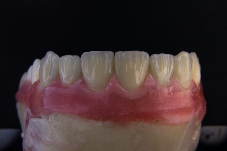 ozkan-guner-13xqZDnYH-o-unsplash